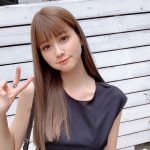 整形失敗した女優の末路ｗｗｗｗｗｗｗｗ オトムス速報 2ch 5chのまとめ